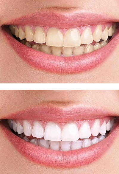 World Smile